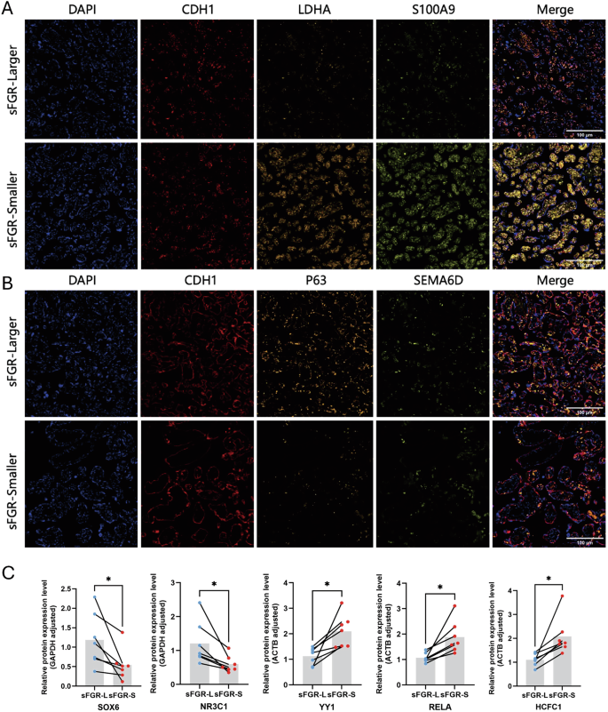 Fig. 7: Validation of differential trophoblast subpopulation signatures in sFGR placentas.