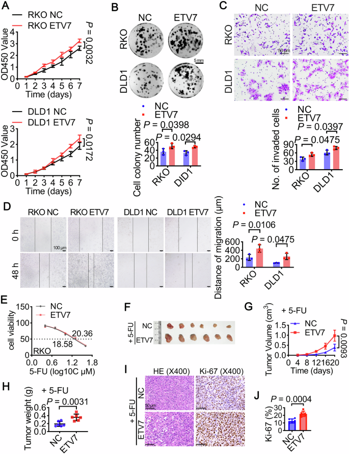 Fig. 2: ETV7 overexpression promotes malignant progression and 5-FU resistance in colorectal cancer.