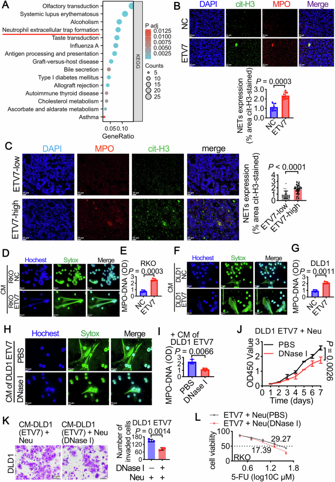 Fig. 4: ETV7 promotes CRC malignant progression and 5-FU resistance through NETs formation.