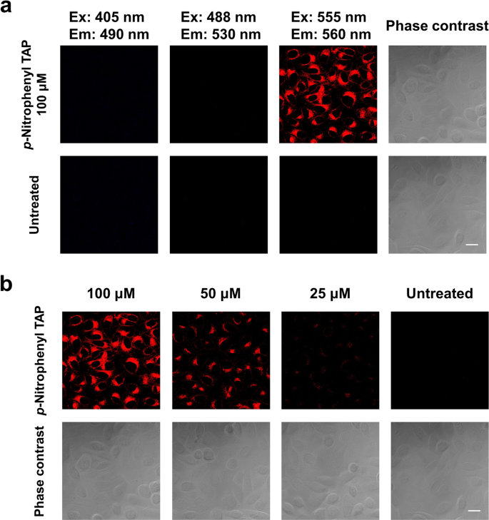 Fig. 4: Observation of 1d in HeLa cells.