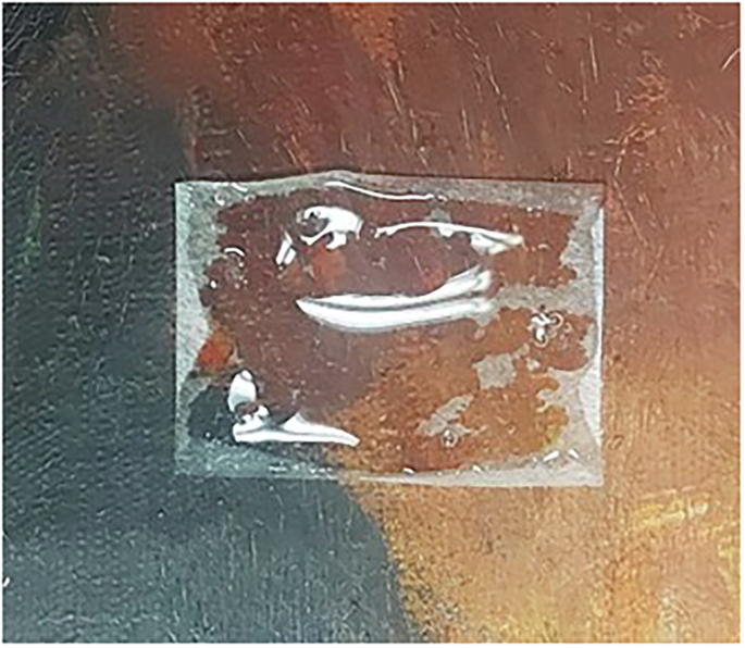 Fig. 24: Controlled cleaning with Amylase Gel and Japanese paper.