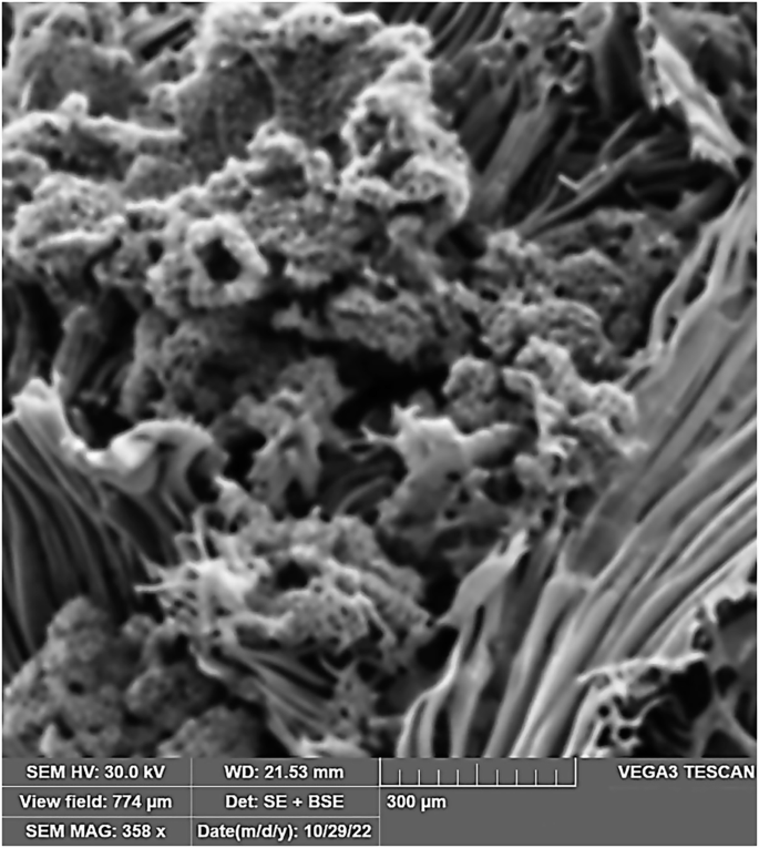 Fig. 7: Scanning electron microscopy of sample S1 B.