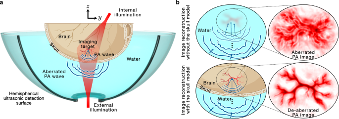 Fig. 1: Schematic of the experimental setup and the image reconstruction scheme.