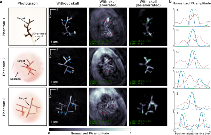Fig. 2: Experimental demonstration of skull de-aberration in PACT.