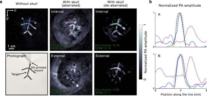 Fig. 3: De-aberration in noninvasive imaging through an ex-vivo adult human skull.