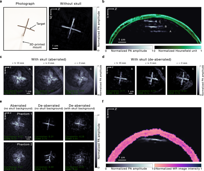 Fig. 4: De-aberration at different phantom positions relative to the skull and for a second ex-vivo skull.