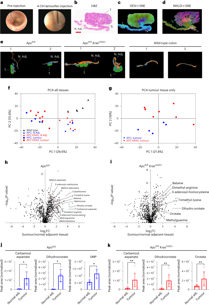 Fig. 2: Metabolic profiling of genetically engineered mouse models of APC-deficient CRC using MSI and LC–MS.