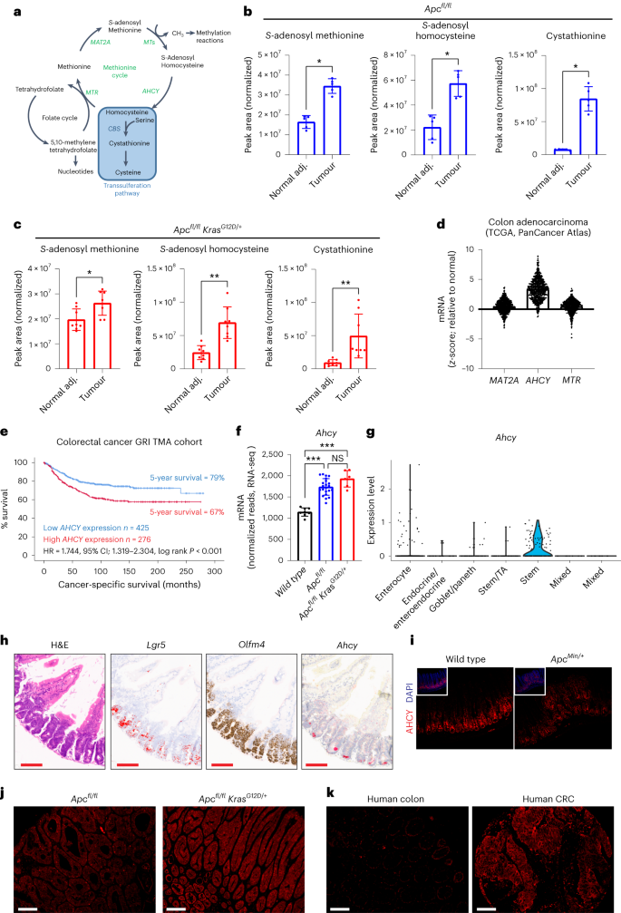 Fig. 3: Methionine cycle activity and AHCY expression in human colorectal cancer and genetically engineered mouse models of colorectal cancer.