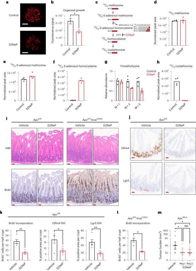 Fig. 4: Inhibition of AHCY suppresses proliferation, stem cell expansion and tumorigenesis in APC-driven models of colorectal cancer.