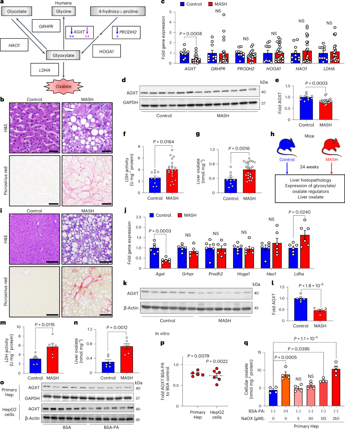 Fig. 1: AGXT is suppressed and LDHA is activated leading to oxalate overproduction in livers from humans and mice with MASH.