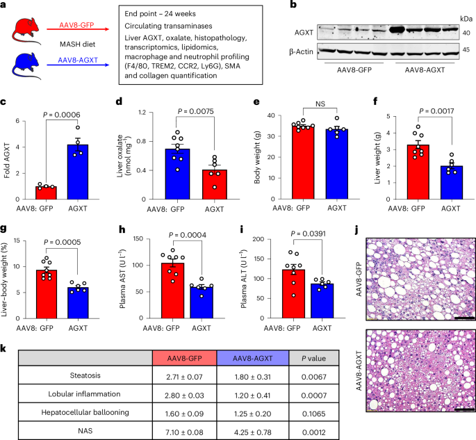 Fig. 2: Oxalate lowering via hepatocyte-specific overexpression of AGXT ameliorates MASH.