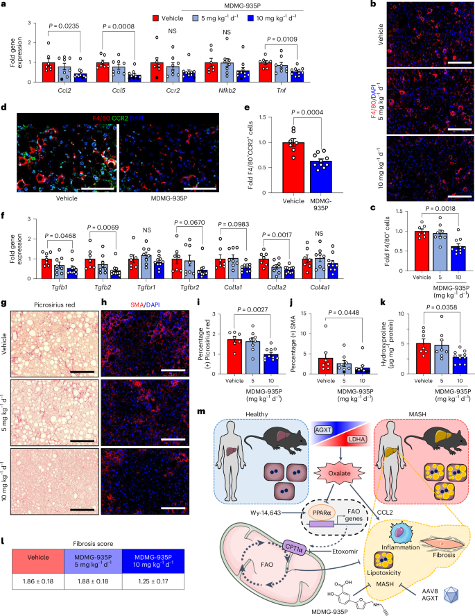 Fig. 8: Pharmacological targeting of hepatic oxalate overproduction reduces hepatic inflammation and fibrosis.