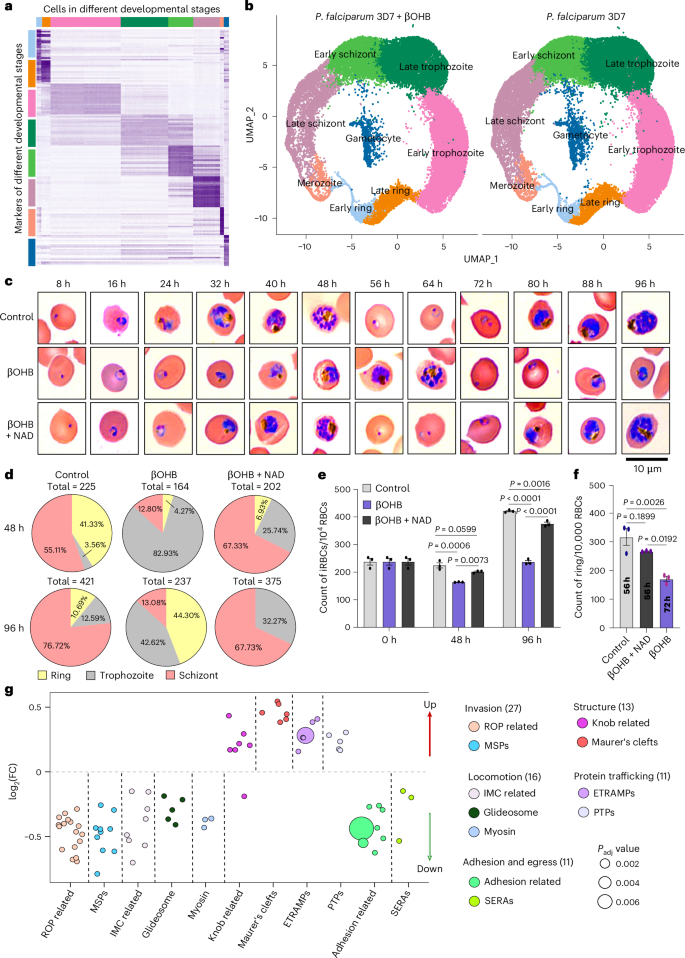 Fig. 3: βOHB blocked the development of P. falciparum 3D7 parasites.