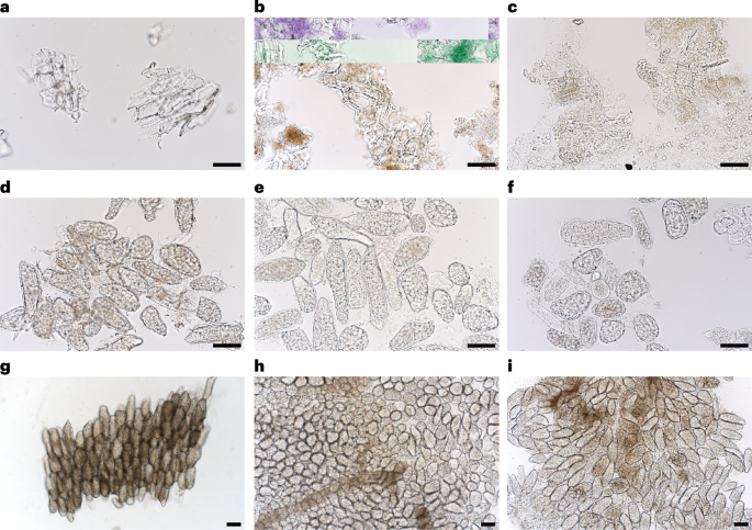 Fig. 4: Micrographs of chickpea cell structures during gastric and duodenal digestion.