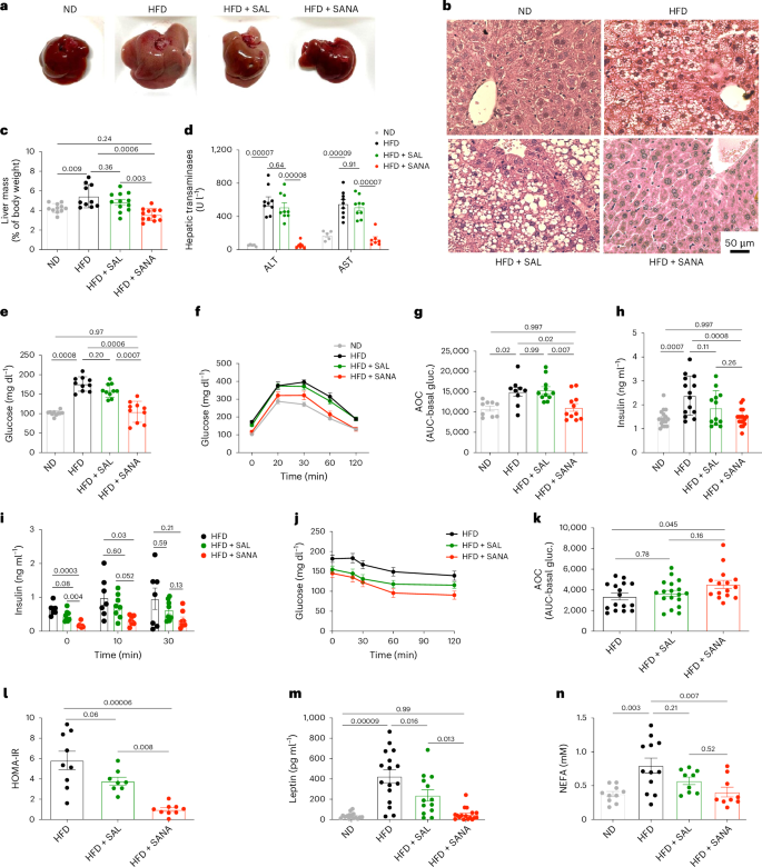 Fig. 2: SANA protects against glucose intolerance and liver steatosis in response to DIO.