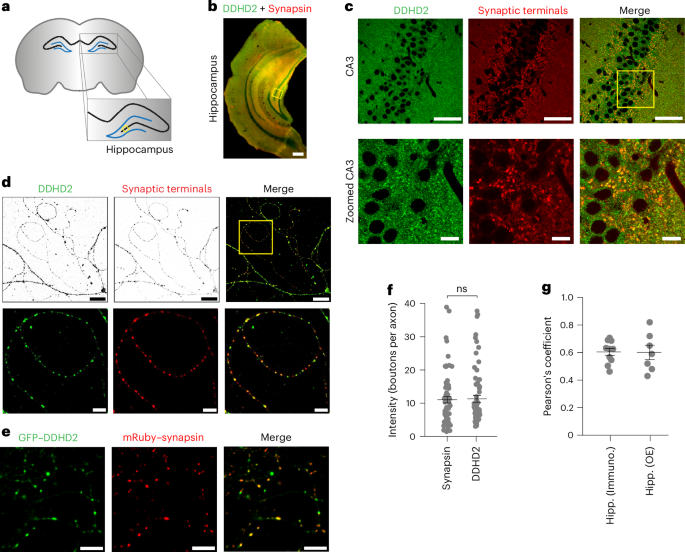 Fig. 1: DDHD2 lipase localizes to synaptic terminals in the hippocampus.