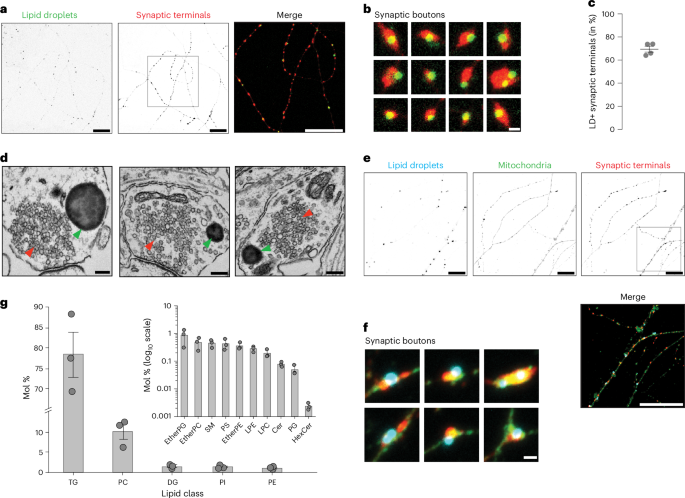 Fig. 2: Inhibition of DDHD2 leads to LD accumulation at synaptic terminals.