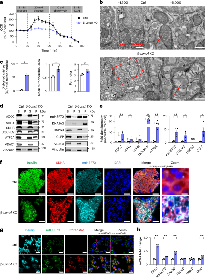Fig. 3: Deficiency of LONP1 results in impaired mitochondrial respiration, accumulation of misfolded mitochondrial proteins and activation of the UPRmt in β cells.