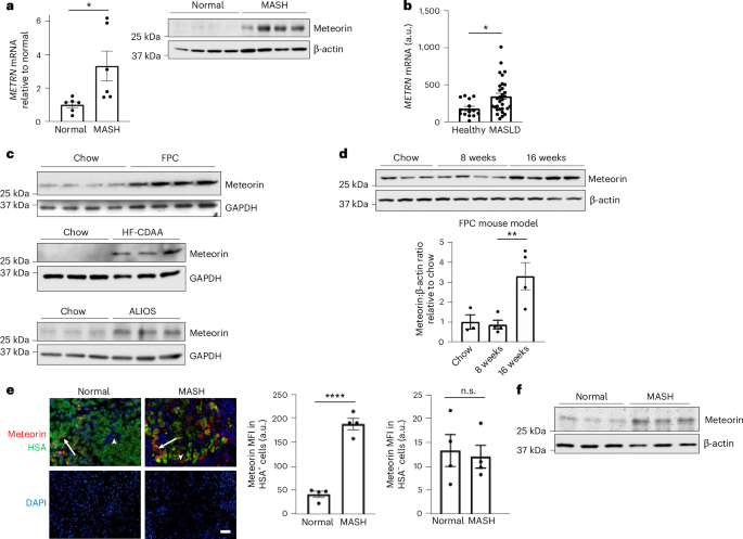 Fig. 6: Meteorin is increased in hepatocytes in MASH liver.