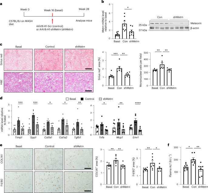 Fig. 8: Silencing of hepatocyte meteorin blocks the progression of liver fibrosis in experimental MASH.