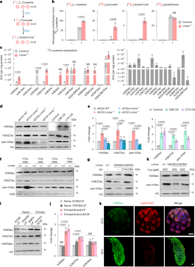 Fig. 3: Enhanced cysteine metabolism upon lamin A/C loss promotes histone acetylation.