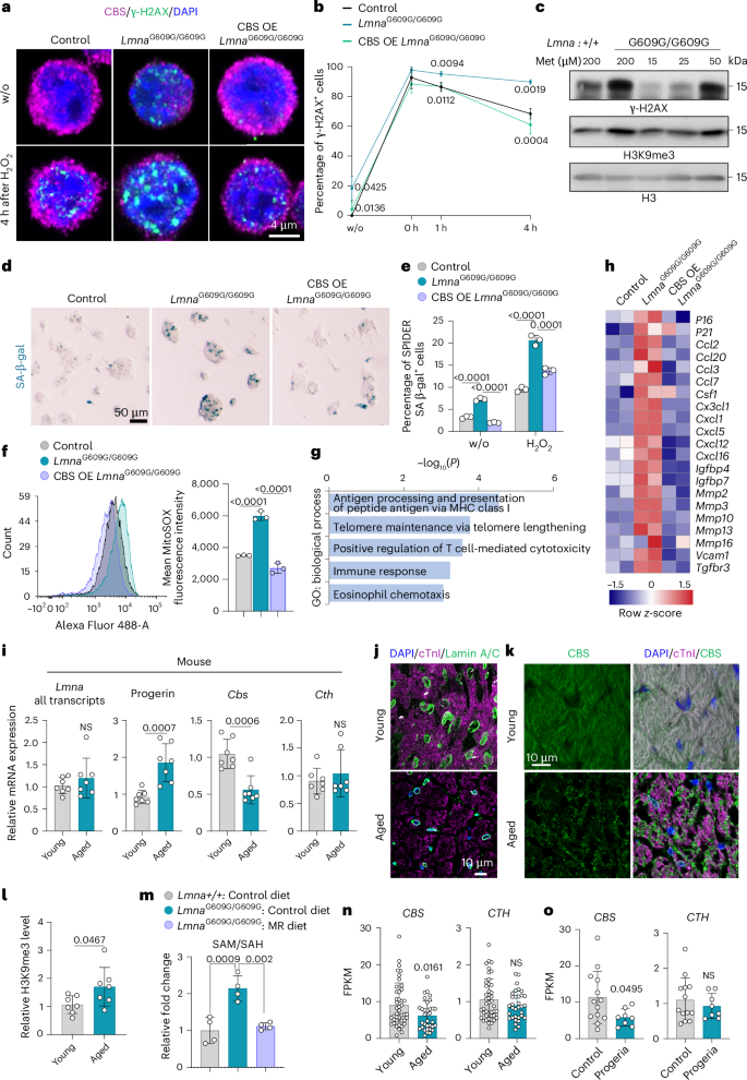 Fig. 8: Lamin A/C-dependent CBS loss leads to DNA damage and senescence.