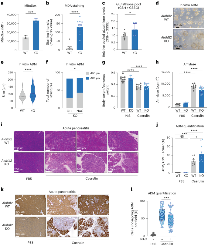 Fig. 2: Deletion of Aldh1l2 in models of ADM and acute pancreatitis.