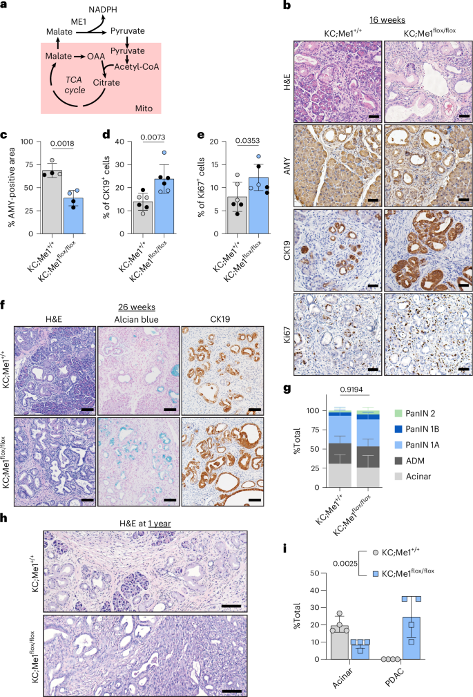Fig. 3: Me1 loss accelerates the formation of early precursor lesions and PDAC progression.