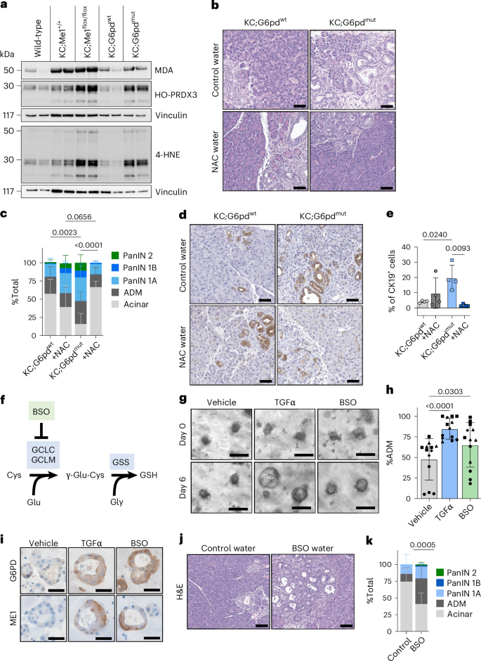Fig. 4: Antioxidants regulate precancerous lesion formation.