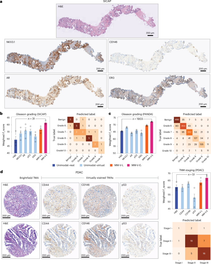 Fig. 6: Transfer learning across scales, cohorts and cancer types.