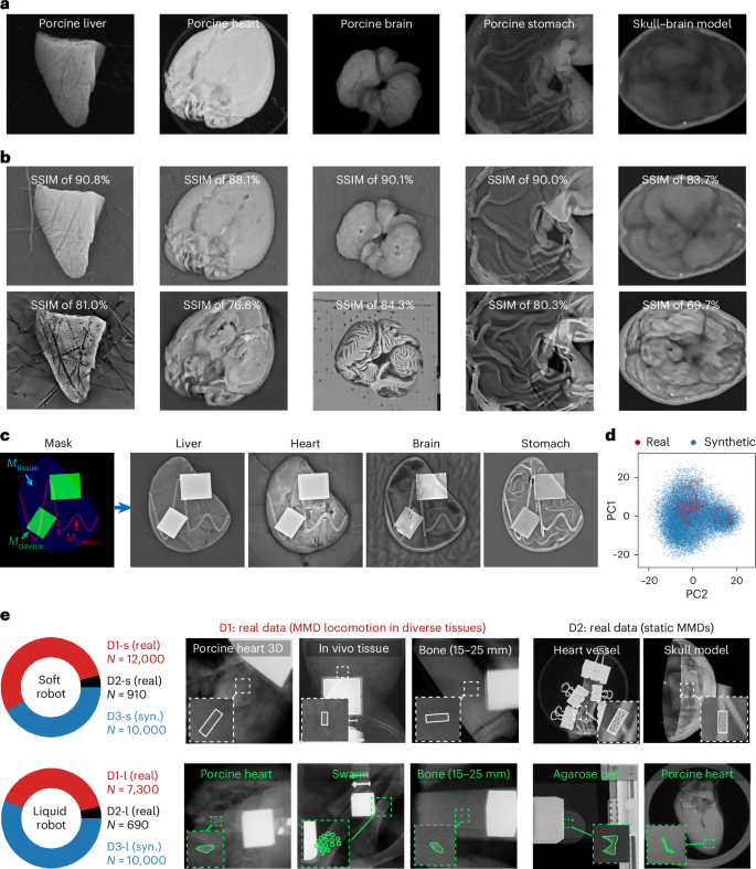 Fig. 3: Domain randomization of synthetic tissue images and open-sourced MMD X-ray dataset.