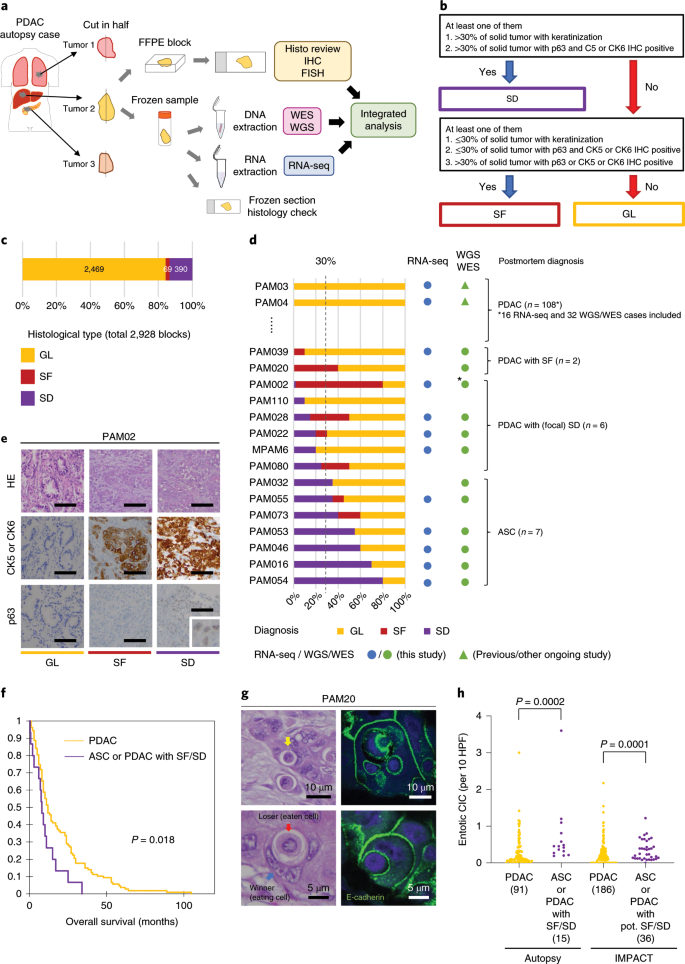 A Unifying Paradigm For Transcriptional Heterogeneity And Squamous Features In Pancreatic Ductal Adenocarcinoma Nature Cancer