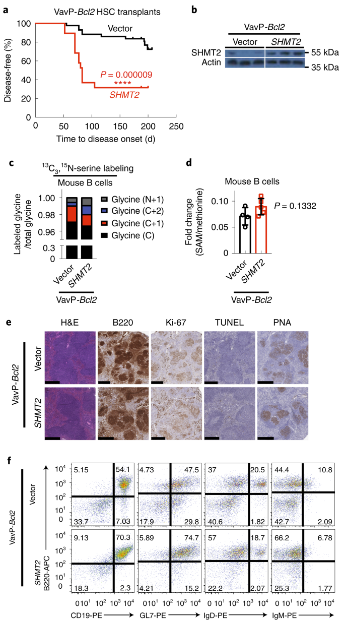The Serine Hydroxymethyltransferase 2 Shmt2 Initiates Lymphoma Development Through Epigenetic Tumor Suppressor Silencing Nature Cancer