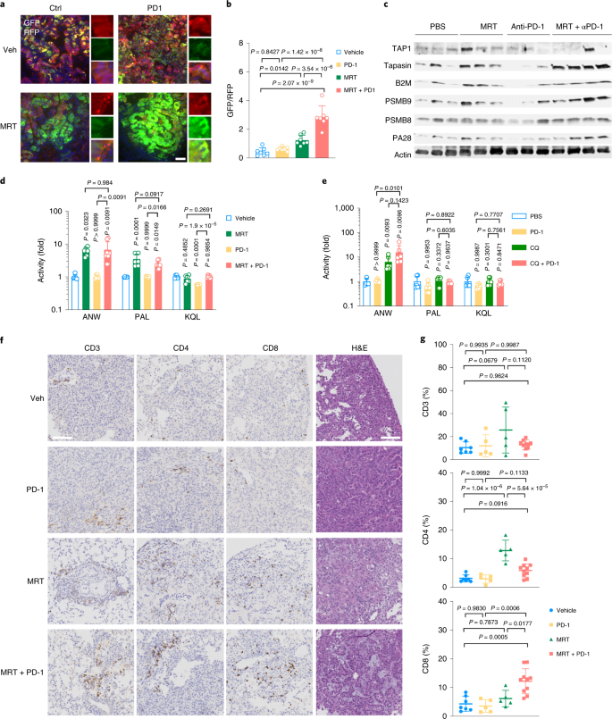 Ulk1 Inhibition Overcomes Compromised Antigen Presentation And Restores Antitumor Immunity In Lkb1 Mutant Lung Cancer Nature Cancer Ulk1 Inhibition Overcomes Compromised Antigen Presentation And Restores Antitumor Immunity In Lkb1 Mutant Lung Cancer Nature Cancer