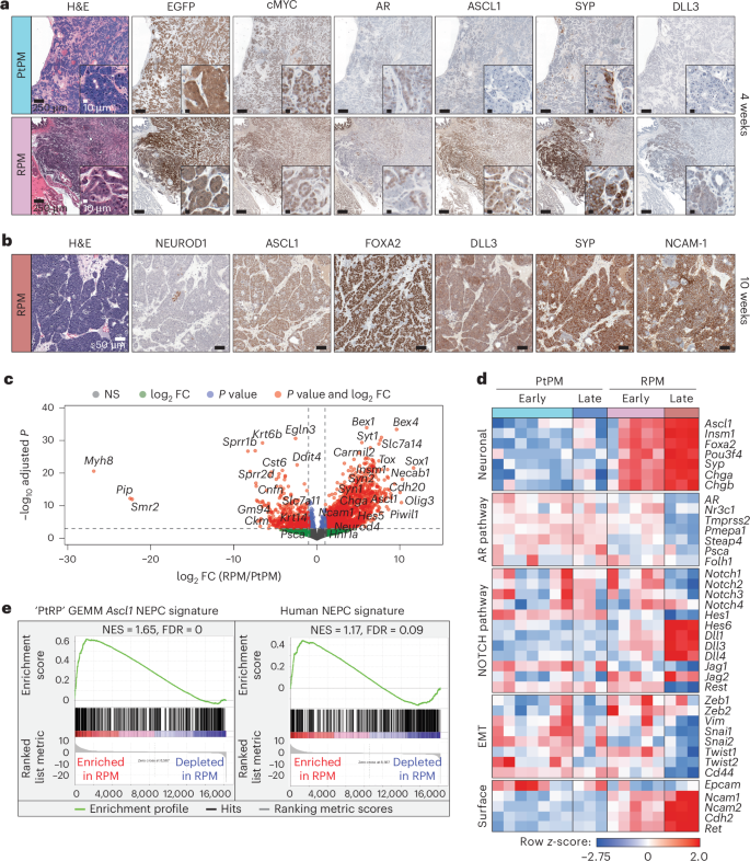Fig. 2: Molecular characterization of PtPM and RPM primary prostate tumor transplants demonstrates emergence of neuroendocrine carcinoma marker expression.