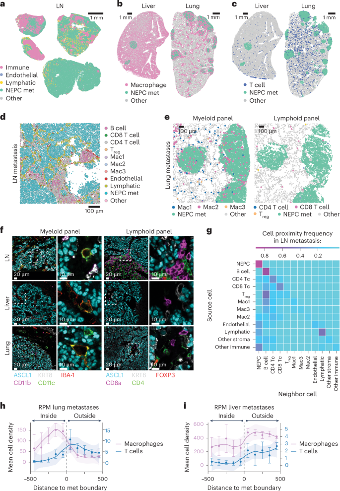 Fig. 4: NEPC metastatic lesions are T cell excluded but retain macrophage infiltrates.