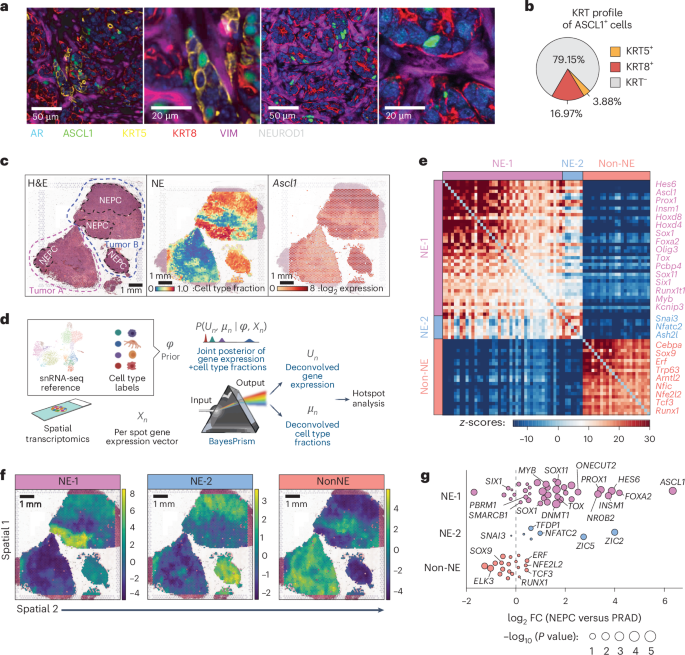 Fig. 5: PrismSpot reveals spatial transcriptomic heterogeneity within NEPC marked by Ascl1 coexpressed with distinct NE-related TFs.
