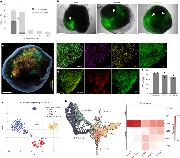 Fig. 2: DMG tumor induction and characterization in brainstem organoids.