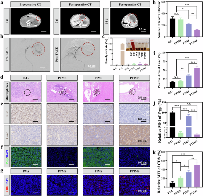 Fig. 7: PTIMS inhibiting VX2 liver tumors in New Zealand rabbits.