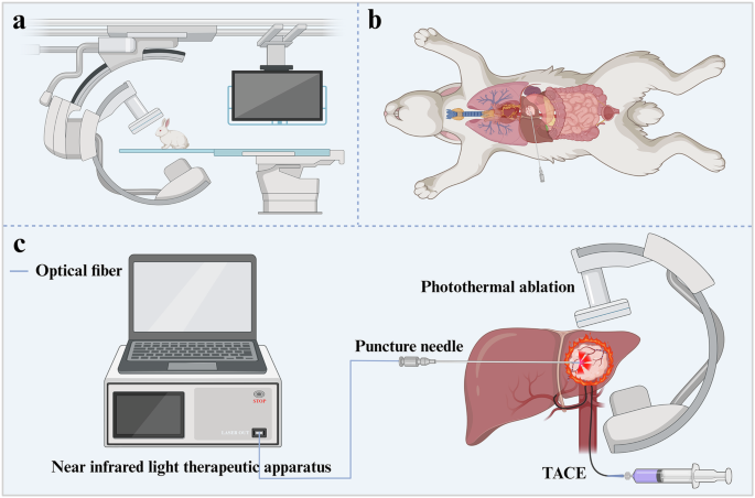 Fig. 8: Schematic illustration of photothermal ablation therapy after TACE treatment in the New Zealand rabbit VX2 liver tumor model.