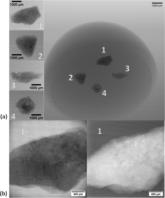 Fig. 5: Radiography projections of the hemisphere.