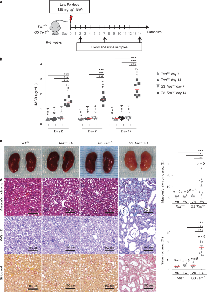 Short And Dysfunctional Telomeres Sensitize The Kidneys To Develop Fibrosis Nature Aging