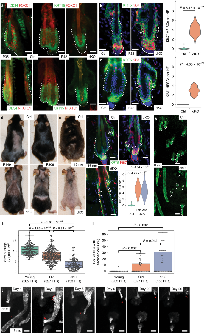 escape of hair follicle stem cells causes stem cell exhaustion during aging nature aging