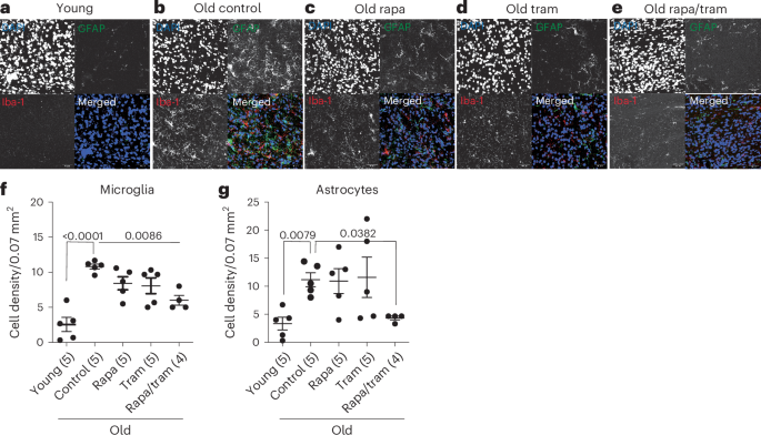 Fig. 5: Combination treatment attenuates age-related microglia activation and astrocyte density in the striatum.