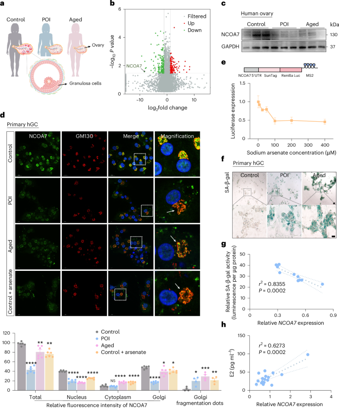 Fig. 2: Decreased NCOA7 expression is associated with GC senescence in individuals with ovarian aging.