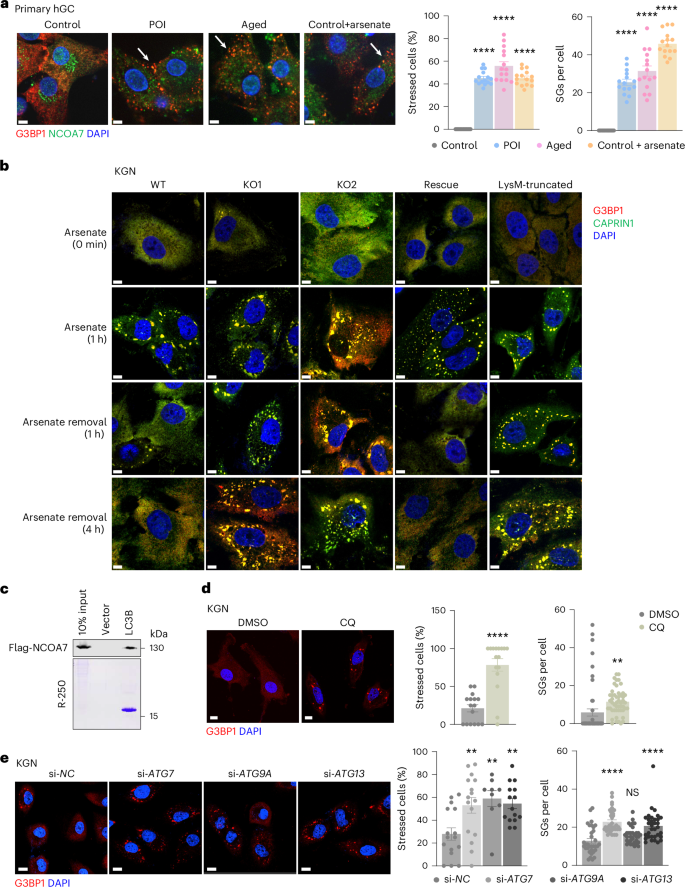 Fig. 5: NCOA7 promotes SG clearance via autophagy after stress removal.