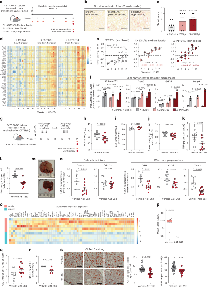 Fig. 7: ABT-263 targets a senescent macrophage signature in MASLD.