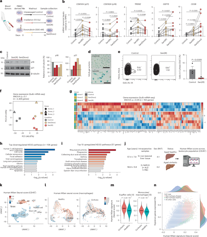 Fig. 8: TREM2+ scar-associated macrophages express a human MSen gene signature.