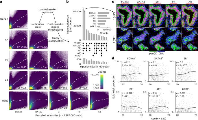 Fig. 2: Luminal heterogeneity of the breast epithelium.