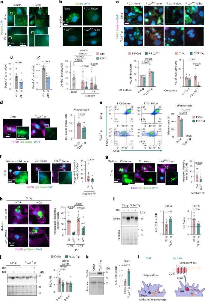 Fig. 4: CMA-defective macrophages display reduced phagocytic and efferocytic capacities.